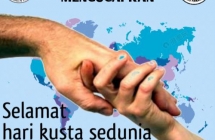 Selamat Hari Kusta Sedunia